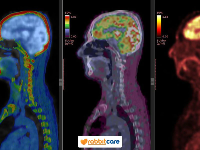 PET Scan / CT Scan / MRI ต่างกันอย่างไร